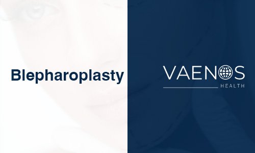 blepharoplasty