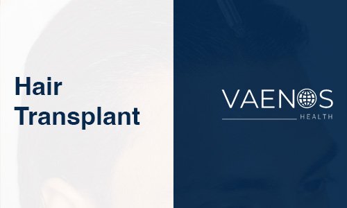 hair-transplant