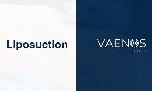 liposuction