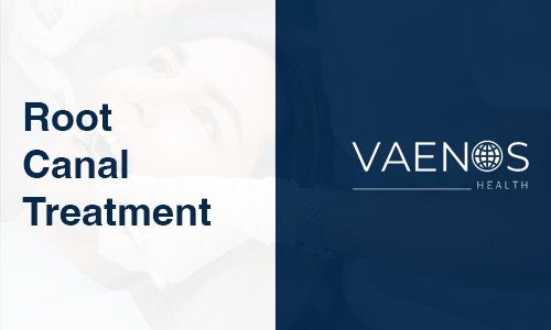 root-canal-treatment