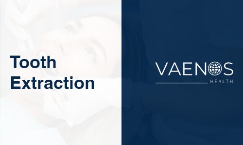 tooth-extraction