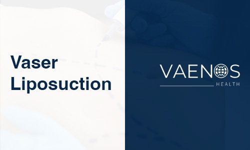 vaser-liposuction